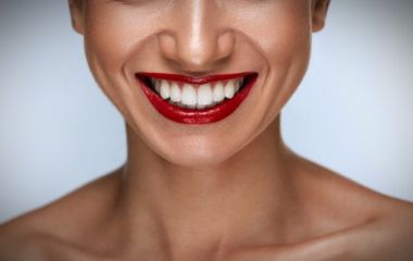 Какие импланты лучше для идеальной улыбки?