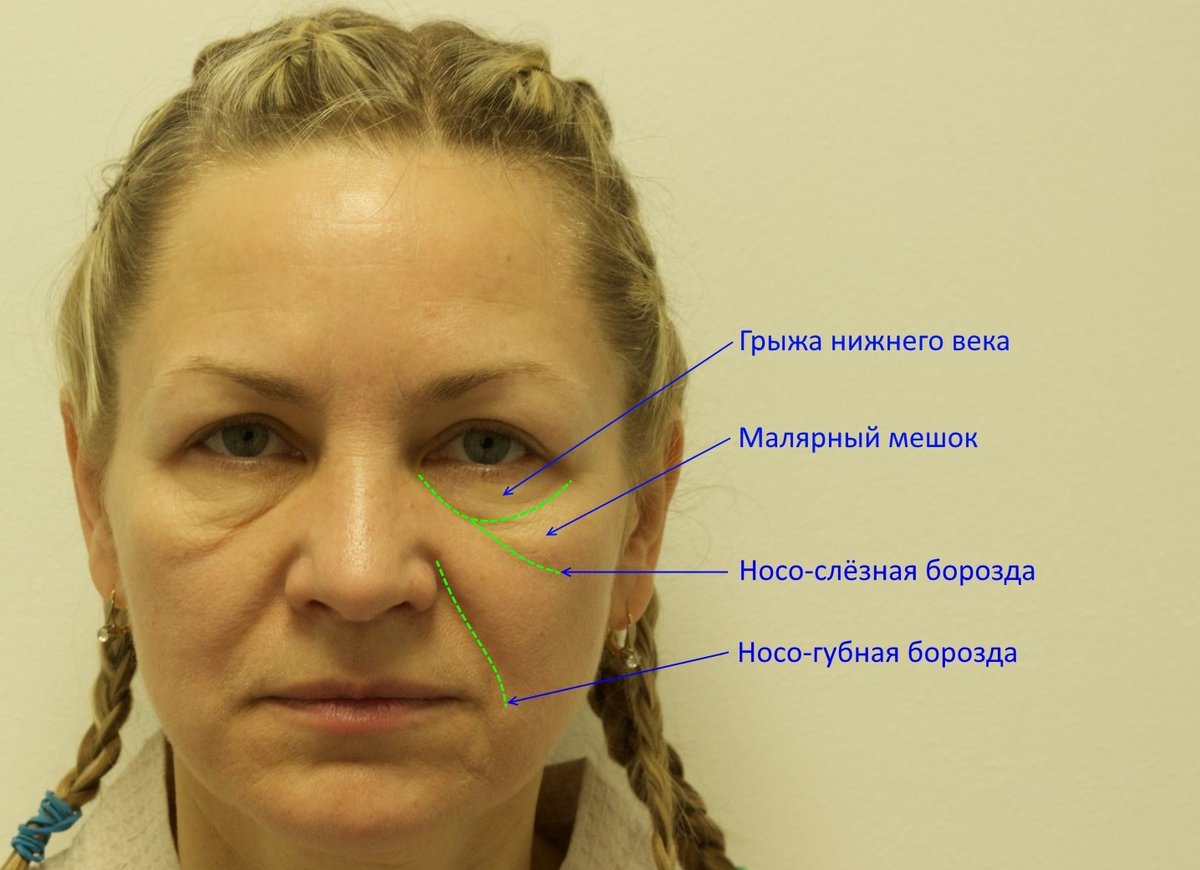 Малярные мешки