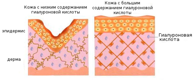 схема состава гиалуронки в тканях
